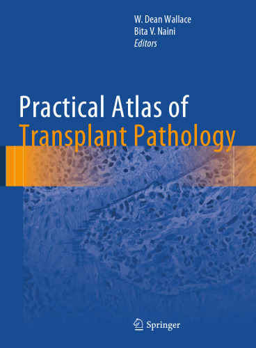 Practical Atlas of Transplant Pathology