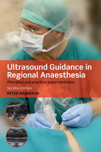 Ultrasound Guidance in Regional Anaesthesia: Principles and practical implementation