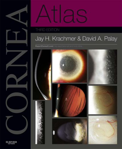 Cornea Atlas