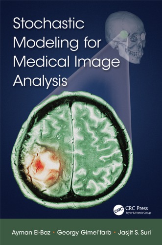 Stochastic Modeling for Medical Image Analysis