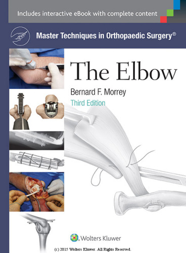 Master Techniques in Orthopaedic Surgery: The Elbow