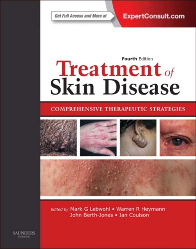 Treatment of Skin Disease: Comprehensive Therapeutic Strategies