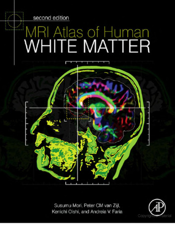 MRI Atlas of Human White Matter