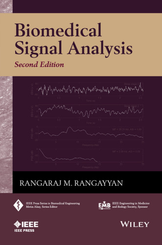 Biomedical signal analysis : a case-study approach