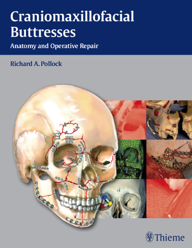 Craniomaxillofacial Buttresses: Anatomy and Operative Repair