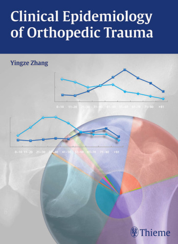 Clinical Epidemiology of Orthopedic Trauma