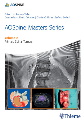 AOSpine masters series. Volume 2, Primary spinal tumors