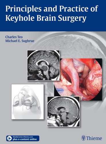 Principles and Practice of Keyhole Brain Surgery