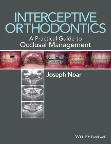 Interceptive orthodontics : a practical guide to occlusal management