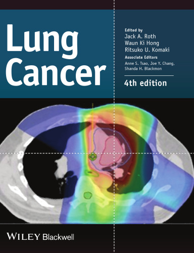 Lung Cancer