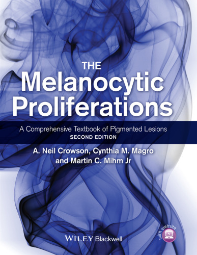 The Melanocytic Proliferations : a Comprehensive Textbook of Pigmented Lesions