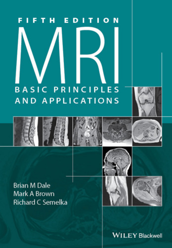 MRI : basic principles and applications