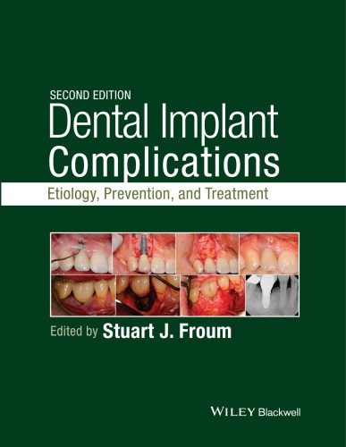 Dental implant complications