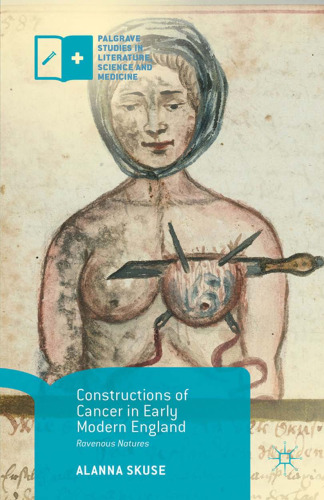 Constructions of Cancer in Early Modern England: Ravenous Natures