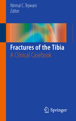 Fractures of the Tibia: A Clinical Casebook