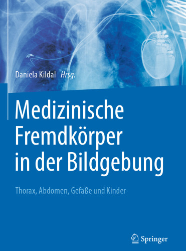 Medizinische Fremdkörper in der Bildgebung: Thorax, Abdomen, Gefäße und Kinder