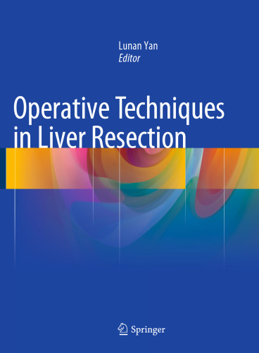 Operative Techniques in Liver Resection