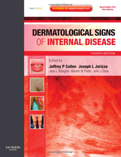 Dermatological Signs of Internal Disease