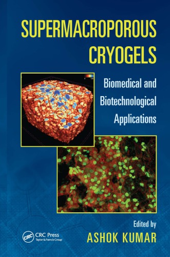 Supermacroporous Cryogels: Biomedical and Biotechnological Applications