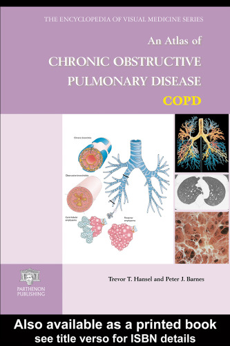 An atlas of chronic obstructive pulmonary disease, COPD