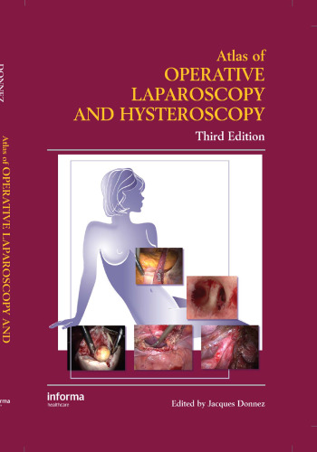 Atlas of operative laparoscopy and hysteroscopy