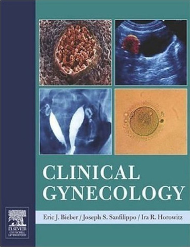 Clinical gynecology