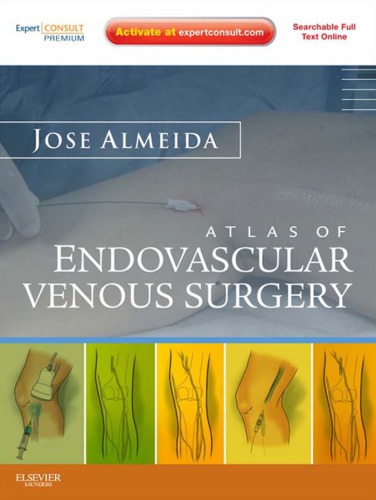 Atlas of Endovascular Venous Surgery