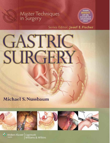 Gastric Surgery