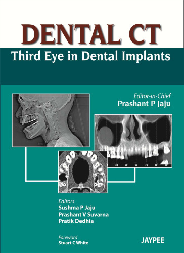 Dental CT: Third Eye in Dental Implants