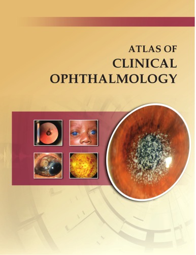 Atlas of Clinical Ophthalmology