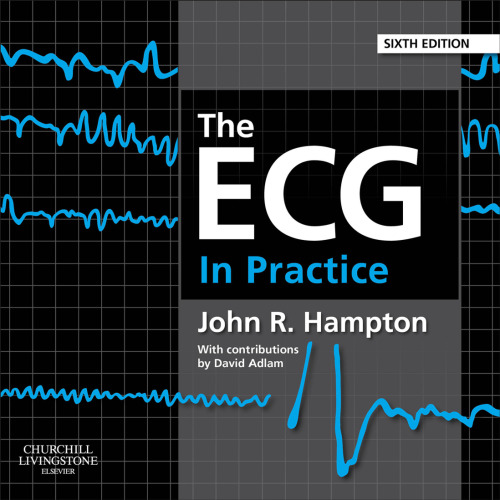 The ECG in Practice