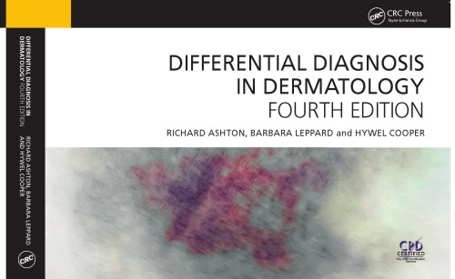 Differential Diagnosis in Dermatology