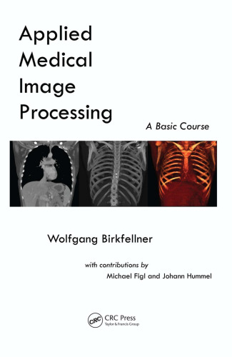 Applied Medical Image Processing, Second Edition: A Basic Course