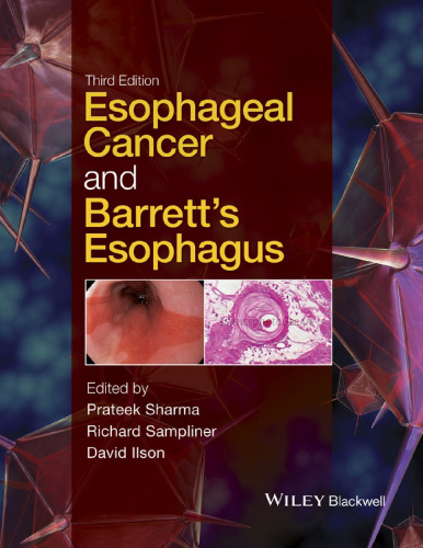 Esophageal Cancer and Barrett’s Esophagus