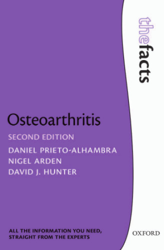 Osteoarthritis: The Facts