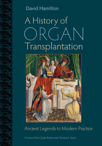 A History of Organ Transplantation: Ancient Legends to Modern Practice