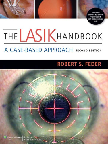 The LASIK Handbook: A Case-Based Approach