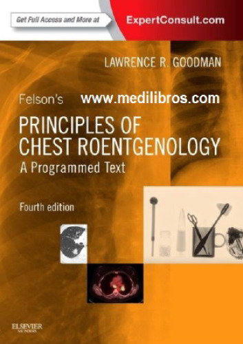 Felson’s Principles of Chest Roentgenology, A Programmed Text