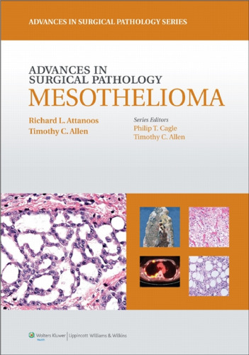 Advances in Surgical Pathology: Mesothelioma