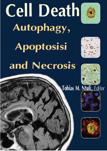 Cell Death Autophagy, Apoptosisi and Necrosis