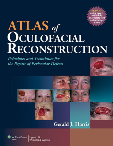 Atlas of Oculofacial Reconstruction: Principles and Techniques for the Repair of Periocular Defects