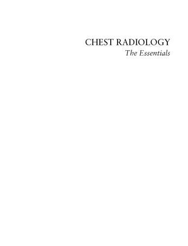 Chest Radiology: The Essentials