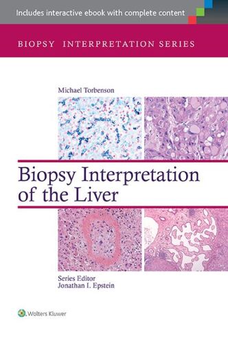 Biopsy Interpretation of the Liver