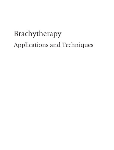 Brachytherapy: Applications and Techniques