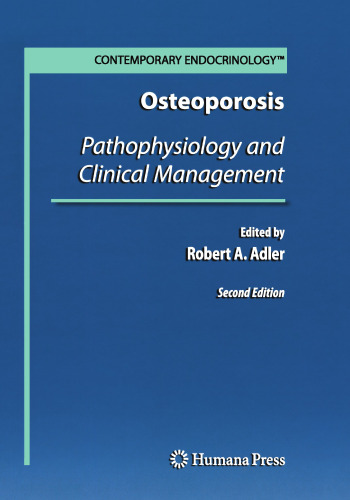 Osteoporosis: Pathophysiology and Clinical Management