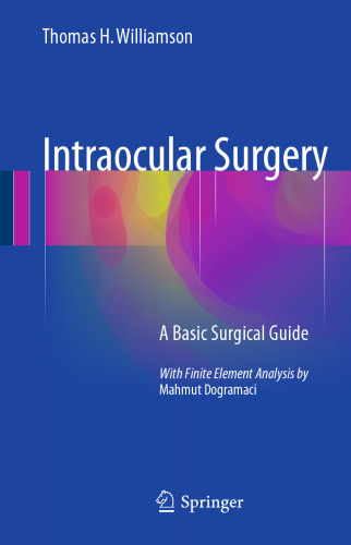 Intraocular Surgery: A Basic Surgical Guide