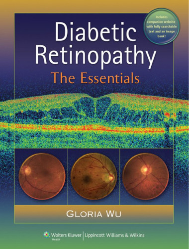 Diabetic Retinopathy: The Essentials