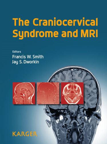 The Craniocervical Syndrome and MRI