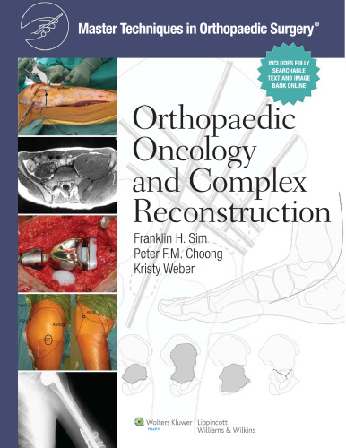 Master Techniques in Orthopaedic Surgery: Orthopaedic Oncology and Complex Reconstruction