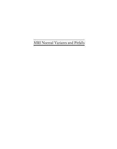 MRI Normal Variants and Pitfalls